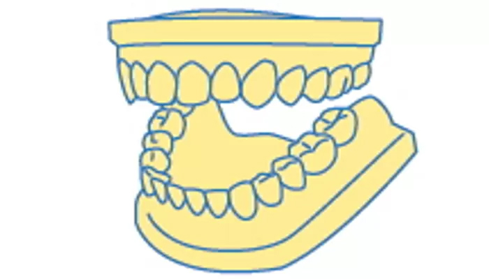 1. 歯の型とり